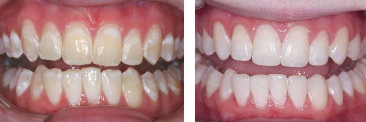 Dental Image Dental Image