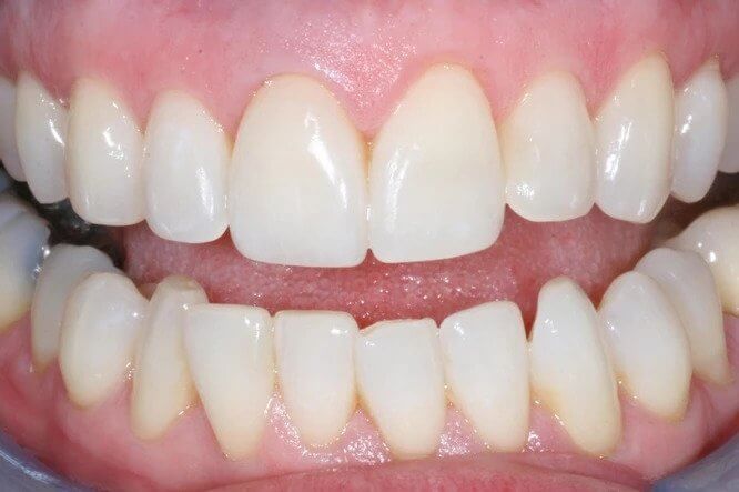 Teeth Image Teeth Image