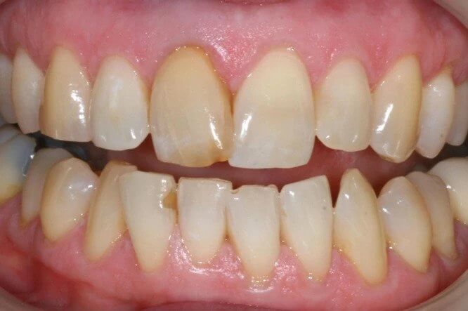 Teeth Image Teeth Image