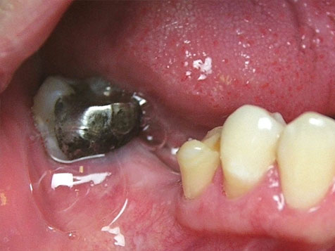 Teeth Image