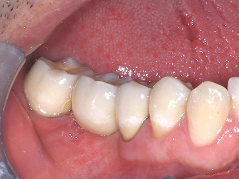 Teeth Image