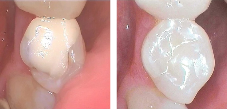 Dental Exellence Dental Exellence