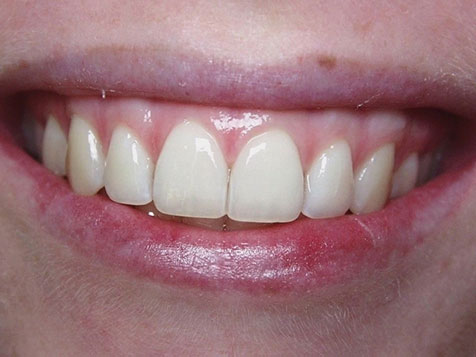 Teeth Image Teeth Image
