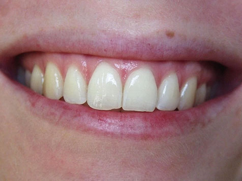 Teeth Image Teeth Image