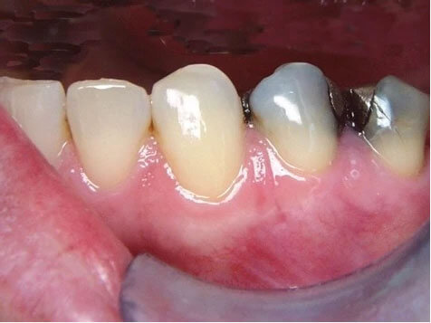 Teeth Image Teeth Image