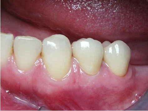 Teeth Image Teeth Image