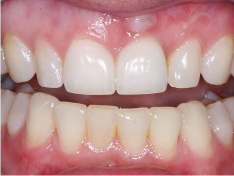 Teeth Image Teeth Image