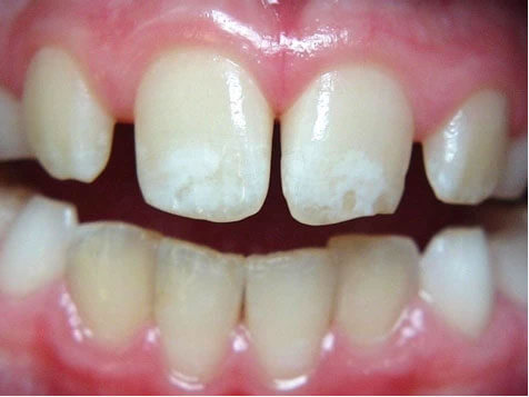 Teeth Image Teeth Image