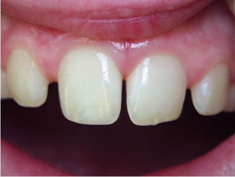 Teeth Image Teeth Image