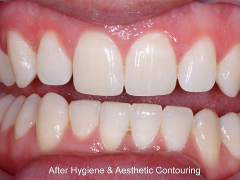 Teeth Image Teeth Image