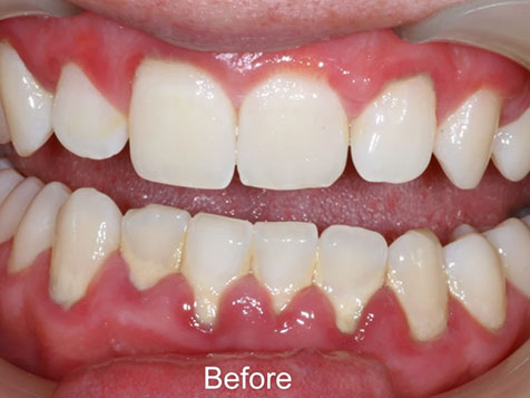 Teeth Image Teeth Image