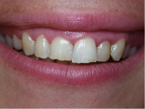 Teeth Image Teeth Image