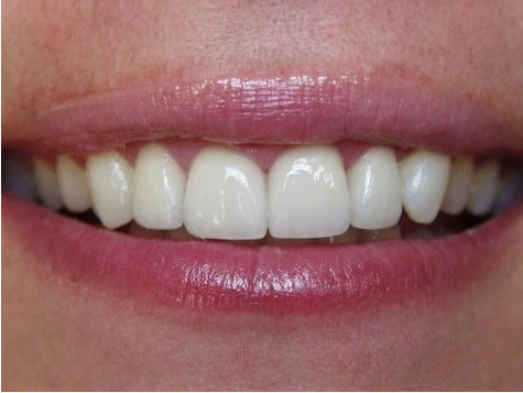Teeth Image Teeth Image