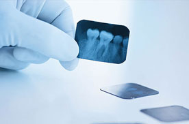 Teeth Image Teeth Image