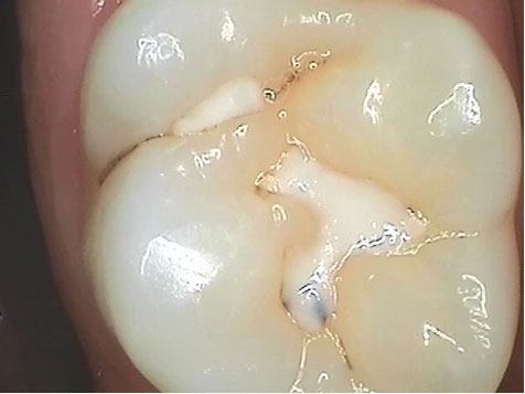 Teeth Image Teeth Image