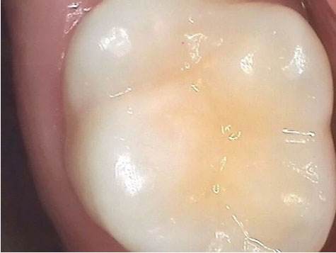 Teeth Image Teeth Image
